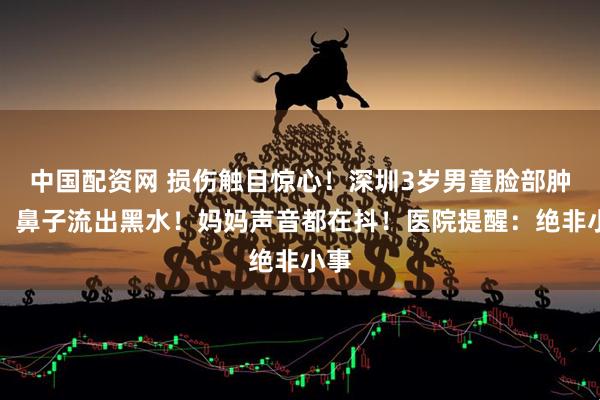 中国配资网 损伤触目惊心！深圳3岁男童脸部肿胀，鼻子流出黑水！妈妈声音都在抖！医院提醒：绝非小事